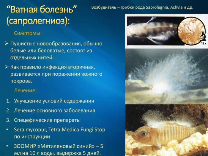 Ватная болезнь