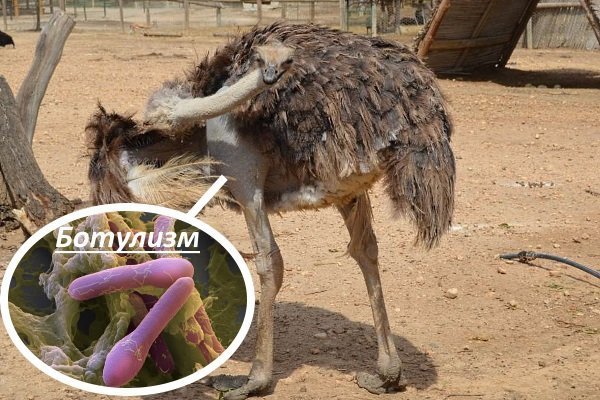 Ботулизм
